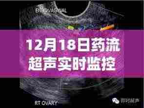 药流超声实时监控下的温馨时光,暖心日常与友共度时刻