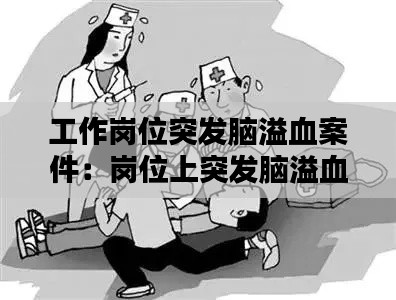 工作岗位突发脑溢血案件:岗位上突发脑溢血怎样赔偿